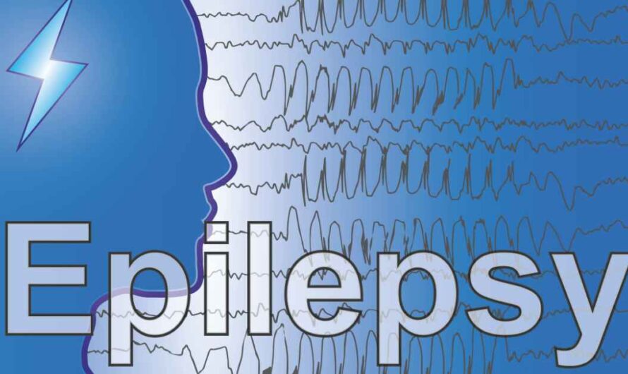 How to avoid epilepsy