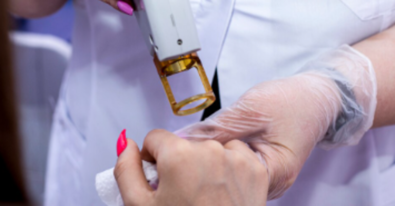 Laser Hair Removal Derb